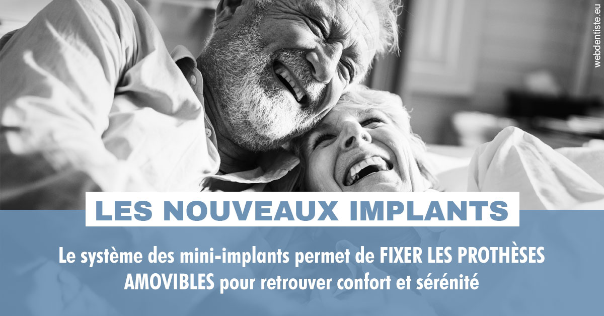 https://www.dr-madi.fr/Les nouveaux implants 2