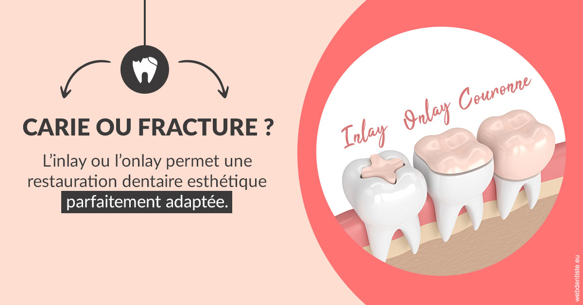 https://www.dr-madi.fr/T2 2023 - Carie ou fracture 2