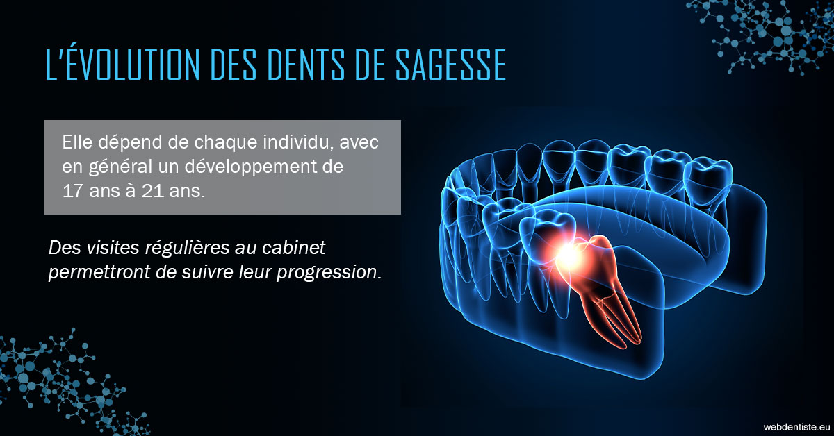 https://www.dr-madi.fr/2023 T4 - Dents de sagesse 01