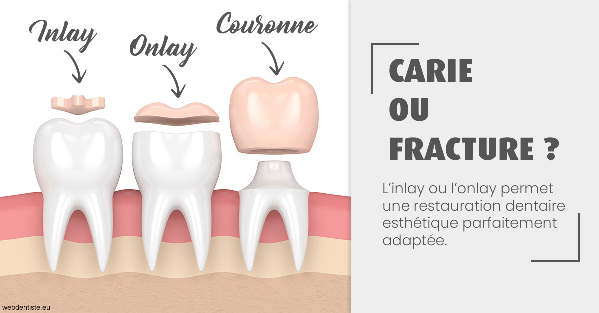 https://www.dr-madi.fr/T2 2023 - Carie ou fracture 1