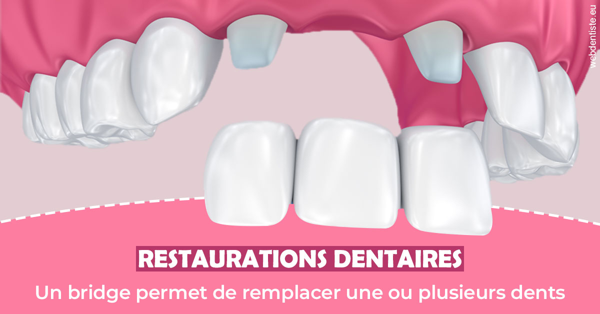 https://www.dr-madi.fr/Bridge remplacer dents 2