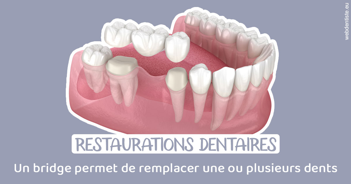 https://www.dr-madi.fr/Bridge remplacer dents 1