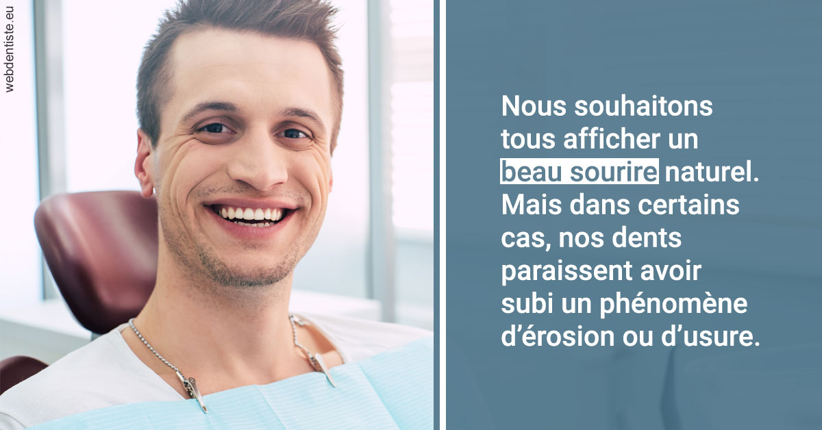 https://www.dr-madi.fr/Érosion et usure dentaire