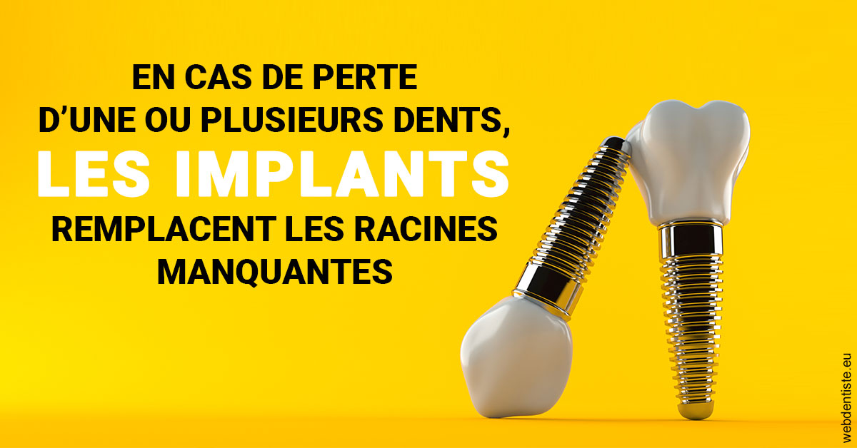 https://www.dr-madi.fr/Les implants 2