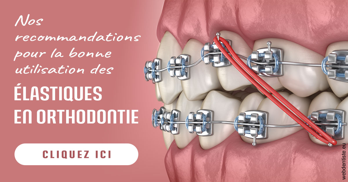 https://www.dr-madi.fr/Elastiques orthodontie 2